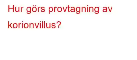 Hur görs provtagning av korionvillus?