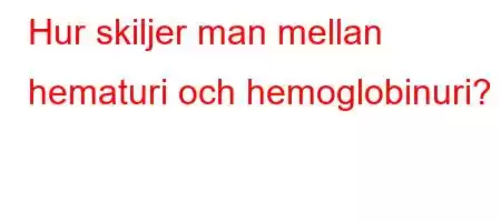 Hur skiljer man mellan hematuri och hemoglobinuri?