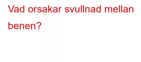 Vad orsakar svullnad mellan benen?